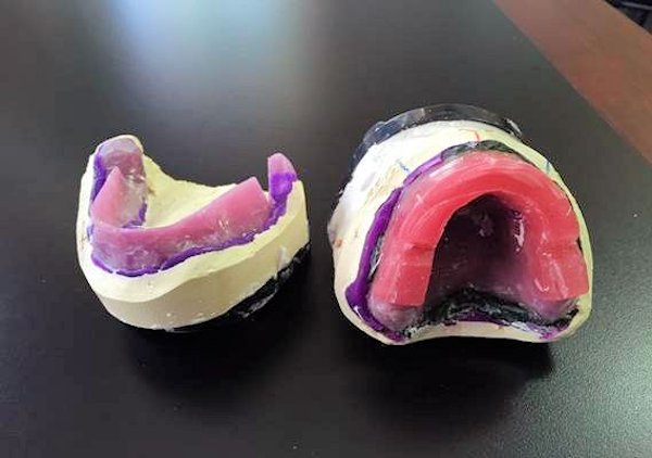 Custom Bite Block Image of Custom Bite Block