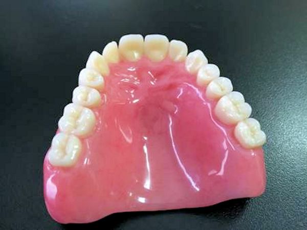 Customized Lower Denture Image of Customized Lower Denture