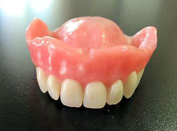 Custom Upper Denture Image of Custom Upper Denture